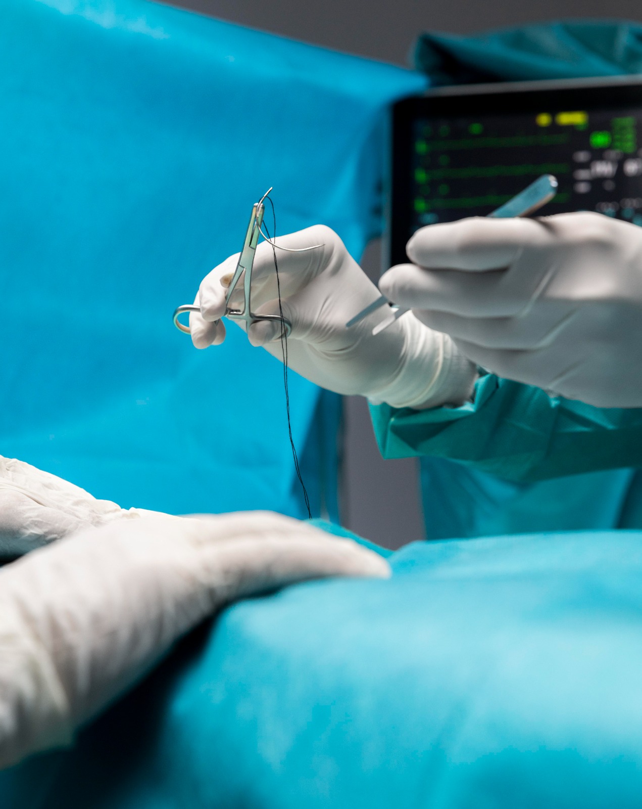 A foto mostra uma cena dentro de um centro cirúrgico. As mãos de dois profissionais de saúde, usando luvas brancas esterilizadas e aventais cirúrgicos azuis, manipulam instrumentos médicos. Um deles segura uma pinça com uma agulha de sutura presa a um fio cirúrgico. Em segundo plano, levemente desfocado, aparece um monitor com sinais vitais em verde. Todo o ambiente é iluminado e coberto por campos cirúrgicos azuis, indicando que um procedimento está em andamento.